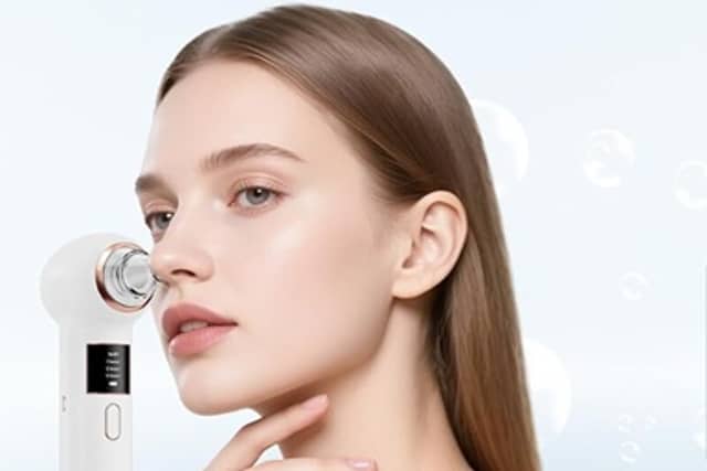 Amazon’s Mylzdobs blackhead remover vacuum is now £24.99, offering a discounted at-home solution for clogged pores