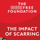 The Impact of Scarring report was released last week from The Scar Free Foundation