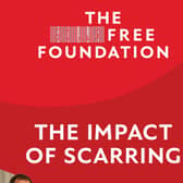 The Impact of Scarring report was released last week from The Scar Free Foundation