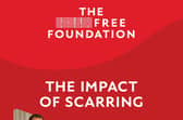 The Impact of Scarring report was released last week from The Scar Free Foundation