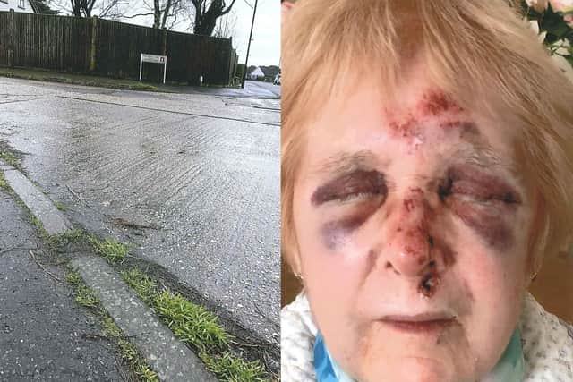 Loraine Stephens was walking home when she fell over while crossing the road in Vermont Drive, at the junction with Vermont Way, East Preston