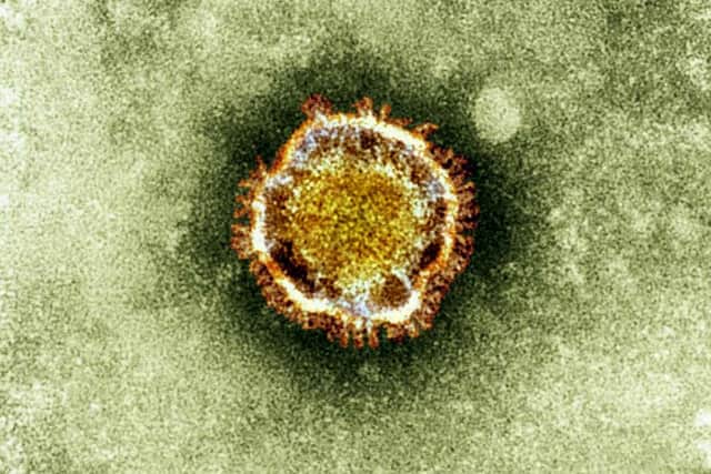 An electron microscope image of a coronavirus.  (AP Photo/Health Protection Agency, File) ENGEMN00120130514091417