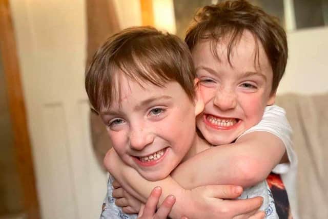 Six-year-old twins Quinn and Jude had to be treated for a rare condition while in their mother's womb