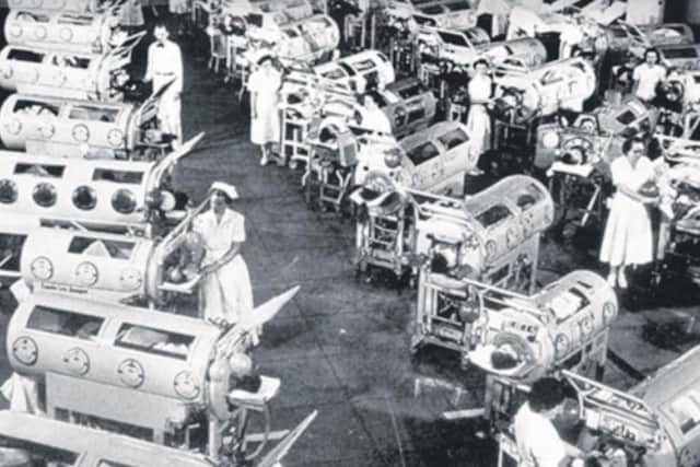 Iron lungs saved many lives, helping people to breathe when their chest muscles were paralysed