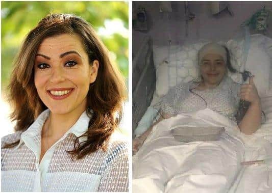 Simona Stankovska, 32, now, and the day after her brain surgery