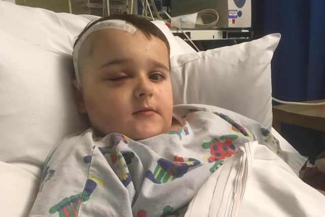 Charlie Clayton, nine, had part of a brain tumour removed