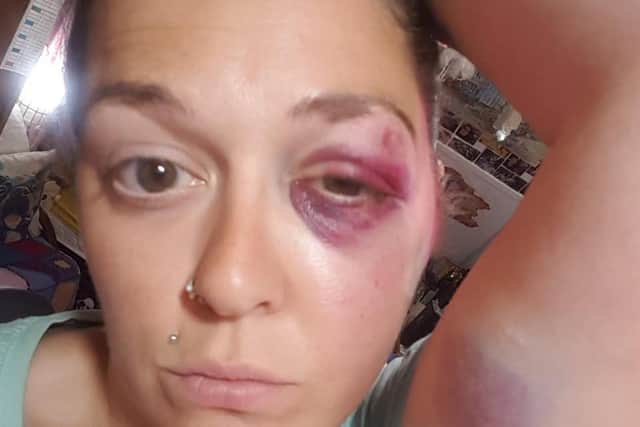 Kay Early was attacked by a stranger in Alexandra Park