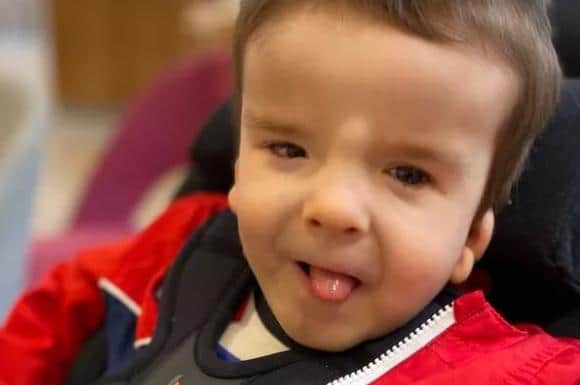 Arty needs constant supervision and medical help because of a rare condition called PolyMicroGyria (PMG)