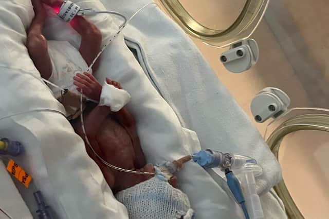 Riley Harris was born 17 weeks early. He is currently receiving treatment and is being monitored in Queen Alexandra Hospital in Portsmouth
