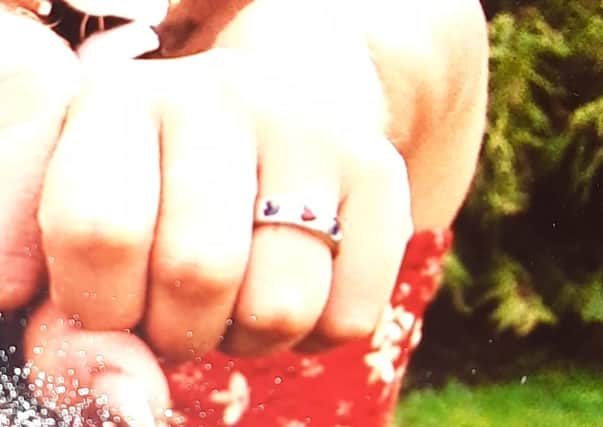 Lizzy Green from Bexhill with her distinctive missing wedding ring.