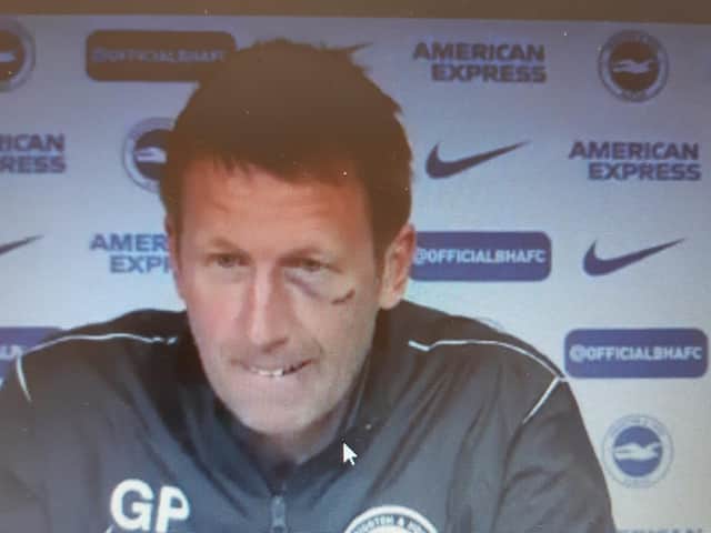 Brighton head coach Graham Potter sporting a shiner and three stiches at today's press conference
