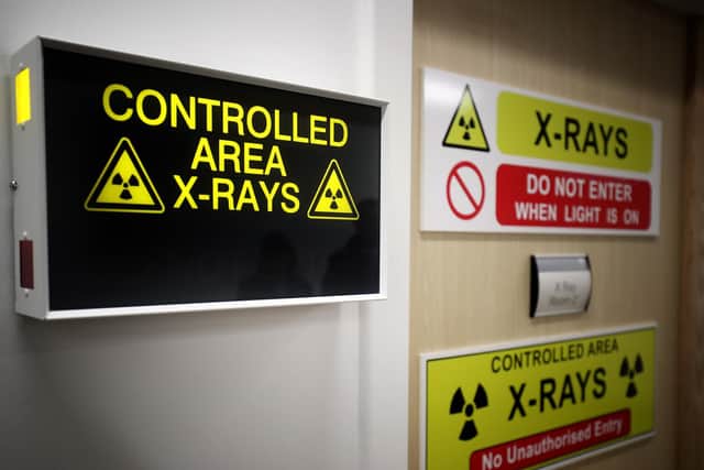 The number of scans used to diagnose cancer dropped by 15 per cent as the coronavirus pandemic hit hospital services at Surrey and Sussex Healthcare