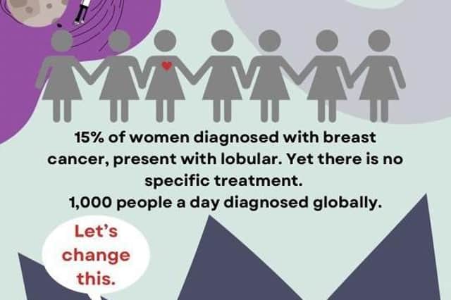 15% of all breast cancers are lobular breast cancer.