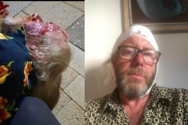 Will Harvey, 65, said he was ‘attacked and beaten’ by a group of youths outside a High Street gym that is the centre for the new ant-bullying and anti-knifecrime incentives set to be launched at the weekend.
