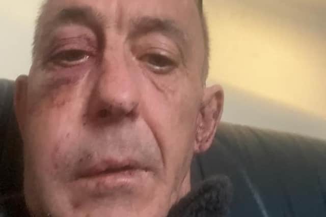 Howard Winter, 59, was attacked in Arundel Road, Littlehampton in the early hours of Saturday morning. Photo contributed