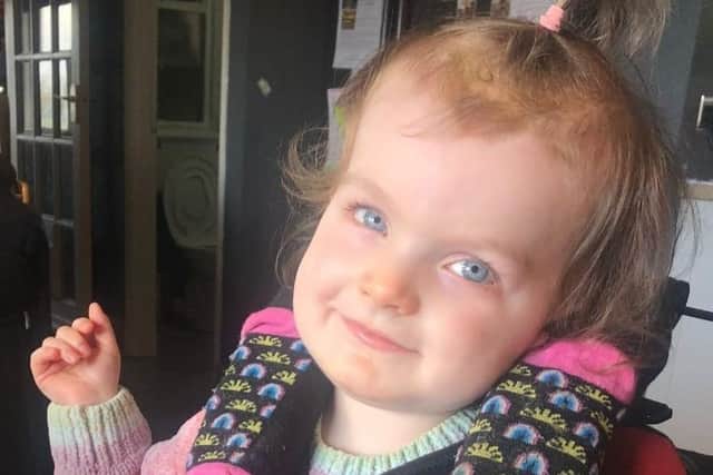 Luna-Rose Vince had Global Development Delay, a rare genetic condition that meant she was immobile, non-verbal and had epileptic seizures