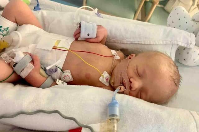 When he was born, Archer was transferred from East Surrey to GOSH where they cared for him from newborn and with multiple operations which as he does took it all in his stride. Picture: Contributed