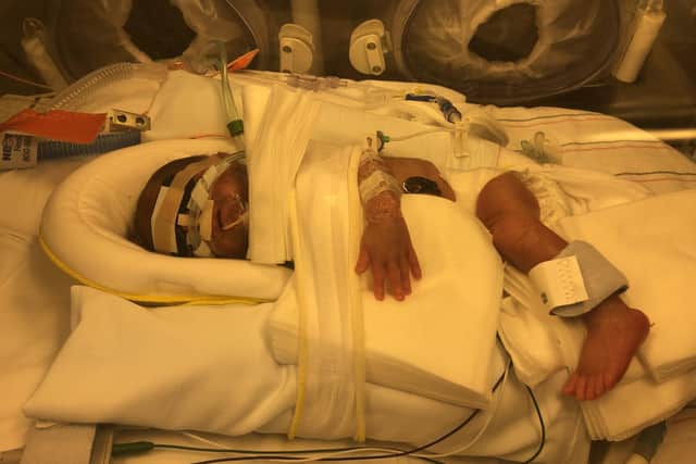 Alfie was born very suddenly and traumatically at 26 weeks gestation, weighing just 2lb 2oz