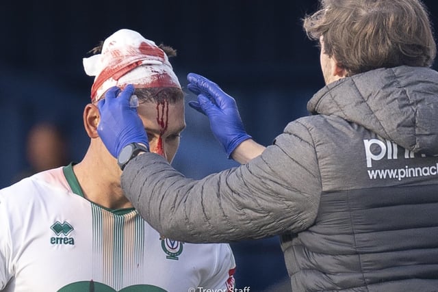Bognor Rergis Town Captain, Craig Robson recieves treatment after a clash of heads:Action from Bognor Regis Town's 3-2 defeat at Billericay