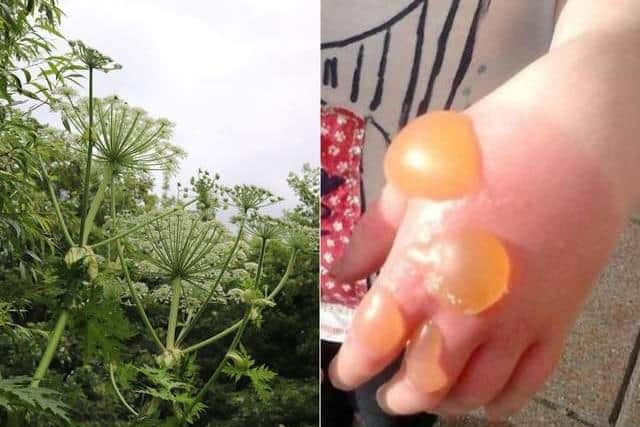 Touching the plant can cause severe skin problems