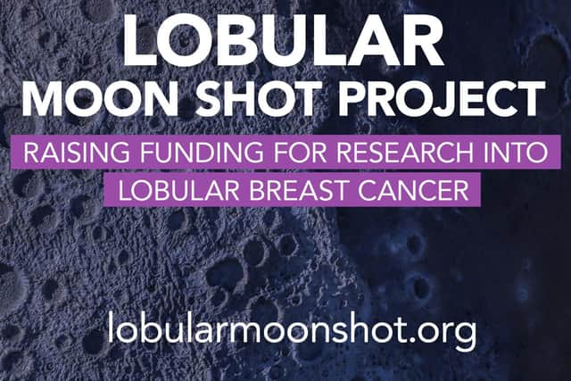 Lobular Moon Shot Project