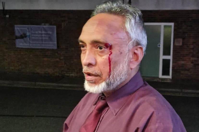 West Sussex village restaurant owner attacked - 'They tried to break all the windows' - Vimarsana News