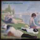 Georges Seurat, Bathers at Asnieres, 1884, Advanced Glaucoma