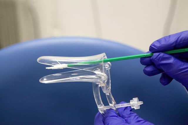 The speculum and soft brush they use for the smear test