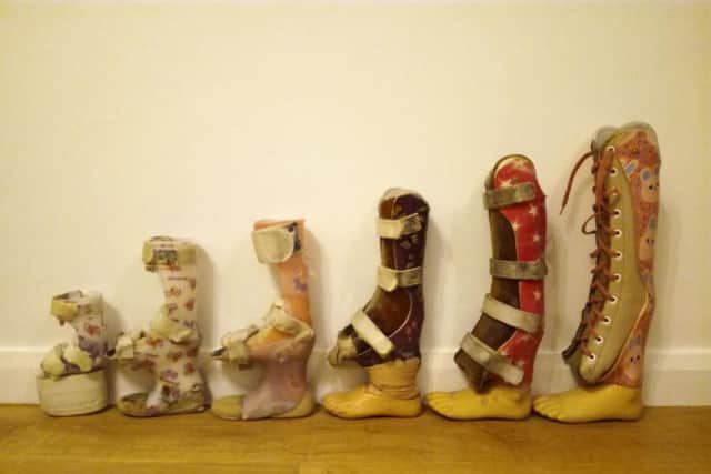 Kyra's prosthetics over the years