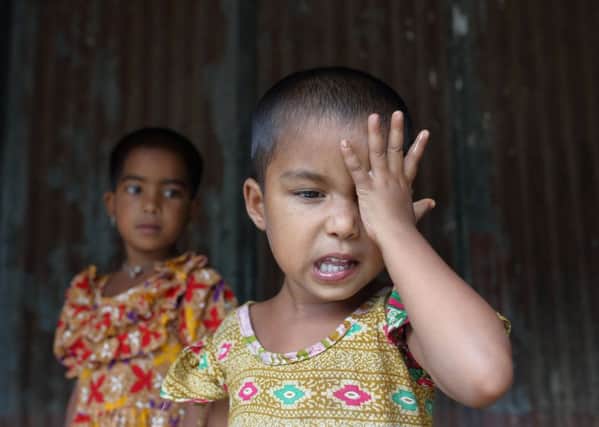 Aklima Akther, 3yr old cataract patient, Netrakona Bangladesh - sister Taslima looks on as Aklima rubs her eyes SUS-180901-114448001