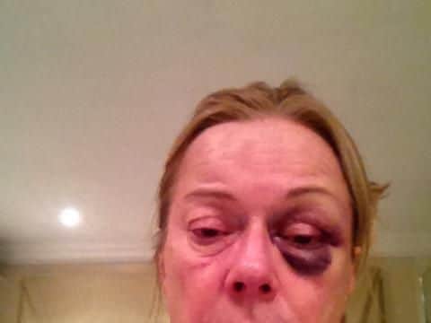 Susan Morris was hit by the Goodwood burglar at a break-in at her home in Surrey.
Image from Surrey Police. Operation Prometheus