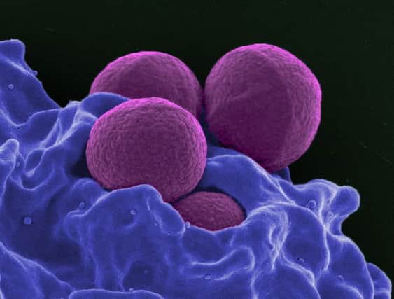Methicillin-Resistant Staphylococcus aureus (MRSA) image licenced by Creative Commons from Flickr by NIAID