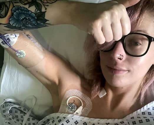 Jessica Newman pictured in 2018 shortly after surgeons connected the intravenous line to her heart  (Credit: Jessica Newman/SWNS)