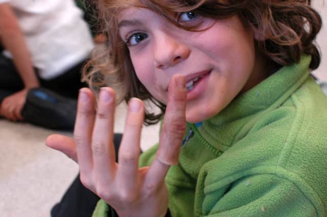 One of the pupils with a prosthetic finger. Photograph by Julia Vogado