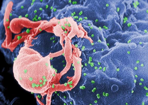 Hiv Budding Color By Photo Credit: C. Goldsmith