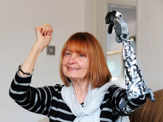 Annastasia Feltham from Clymping is delighted with her 3D printed arm. Picture: Kate Shemilt