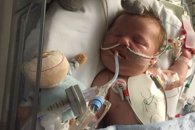 Oscar was admitted to the paediatric intensive care unit at Southampton Children's Hospital at four weeks old