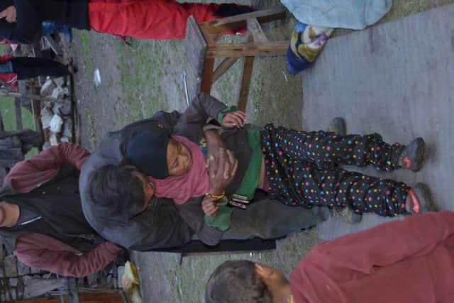 A young girl injured in the disaster. Most of the villagers were outside when their homes crumbled, limiting the death toll
