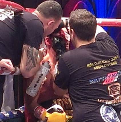 Ben Jones receives treatment to his cut cheek against Martin Parlagi fighting for the WBO Inter-Continental featherweight title. Picture by Graham Carter SUS-151031-101913002