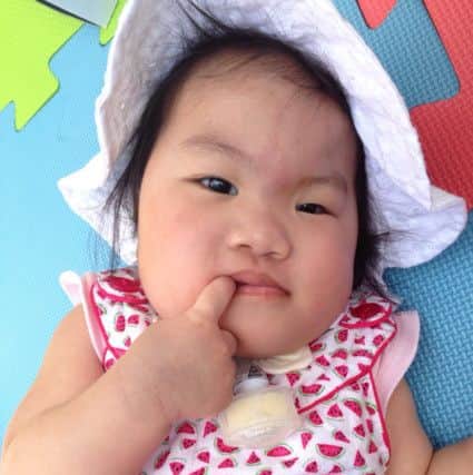 Jenny's 18-month-old niece Eva Ng-Ho, who was born with CHARGE syndrome