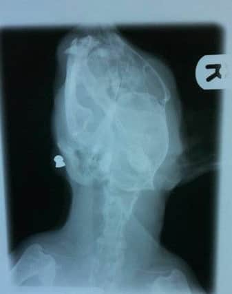 An x-ray revealed the air gun pellet lodged in Bobby's neck.