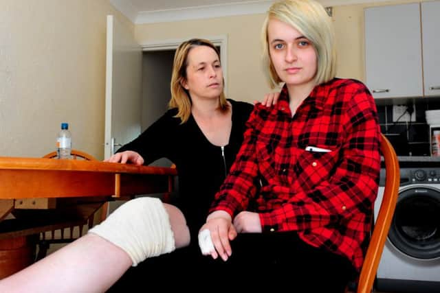 Lianne Ritchie and her daughter Natasha Colin, who was injured in a hit and run accident when she was riding her bike. Picture: Kate Themilt