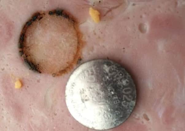 A slice of ham burned by a button battery after just 15 minutes contact SUS-160612-101842001