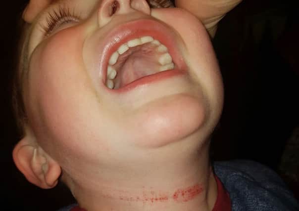 Toddler Strangles Toddler '˜strangled' by rope at St Leonards holiday park