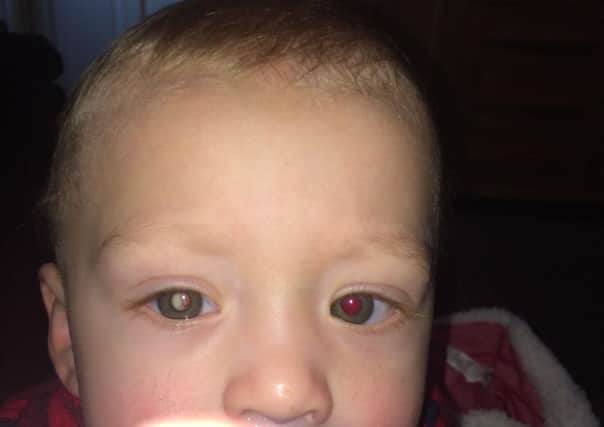 The photo of Jaxson, one, showing a white reflection in his eye which was then diagnosed as retinoblastoma