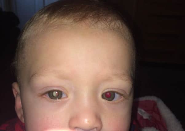 The photo of Jaxson  showing a white reflection in his eye which was then diagnosed as retinoblastoma