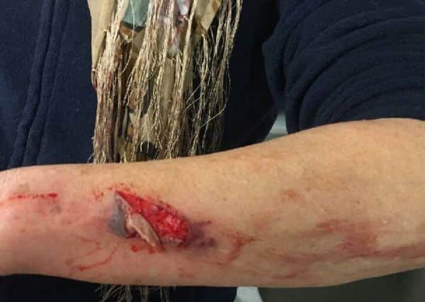 A woman suffered a nasty gash to her arm after tripping over a bollard on High Street in Rye SUS-170803-173116001