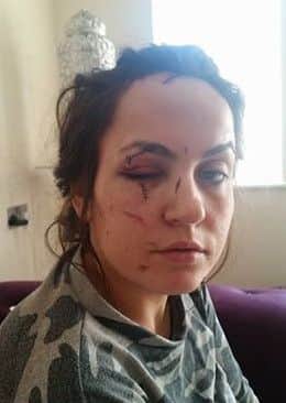 Faye Sharpe, 24, who was attacked by Karl Gates.