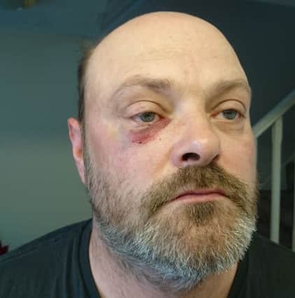Neil Bennett was attacked and had his car tyres slashed