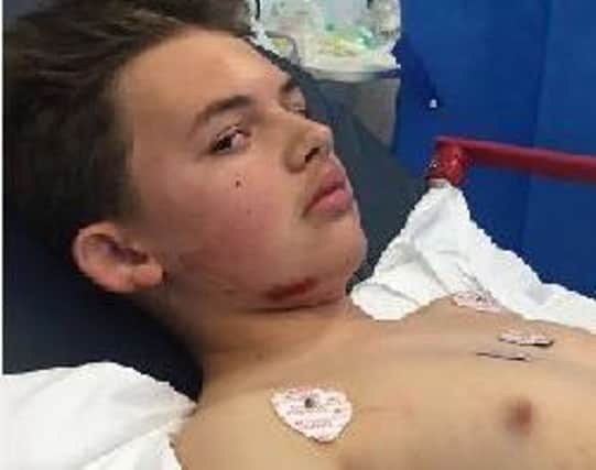 Callum Nicholls was taken to the Conquest Hospital in Hastings